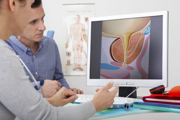 prostate diagram on computer Enlarged Prostate