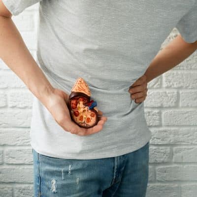 Man holding a kidney replica with kidney stones